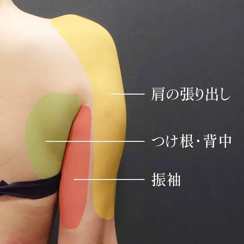 肩の張り出しの吸引部位