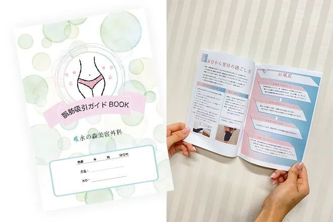 脂肪吸引ガイドBOOK