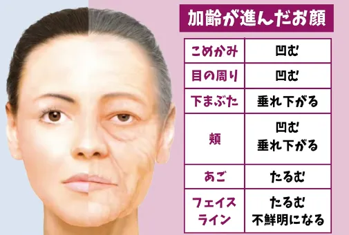 加齢が進んだお顔の変化（こめかみ・目の周り・下まぶた・頬・あご・フェイスライン）