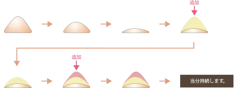 ヒアルロン酸を繰り返し注入することで効果が積み重なるイメージ