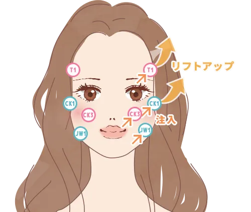 8ポイントリフトの注入イメージ