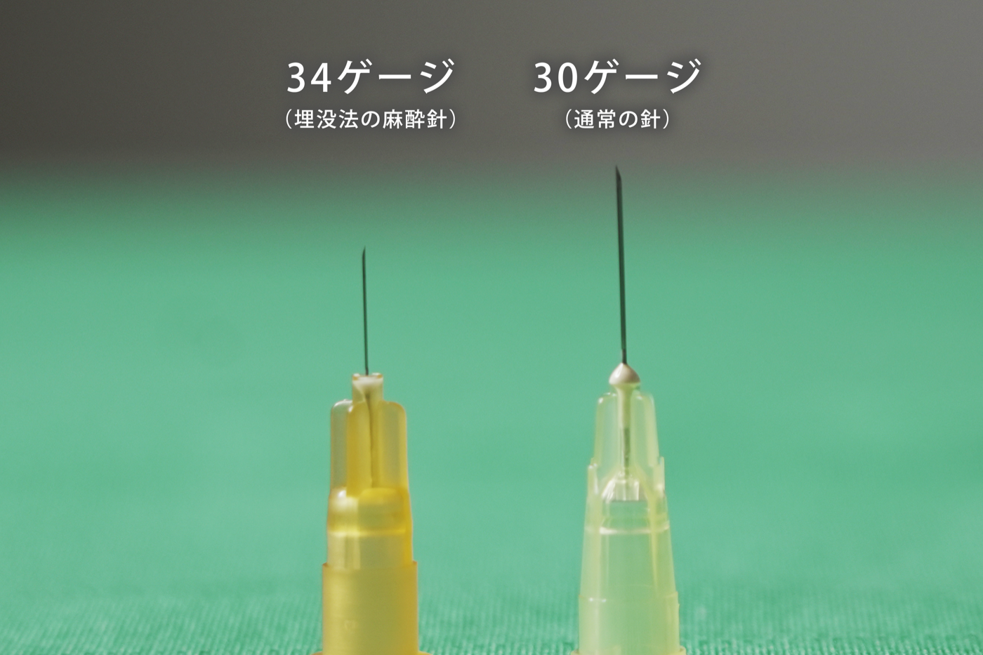 34ゲージと30ゲージの麻酔針の比較